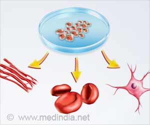 India Appeals for Stem Cell Donors to Battle Blood Disorders
