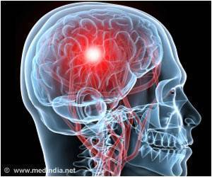  Management of Anticoagulant-Associated Intracerebral Hemorrhage Highlighted
