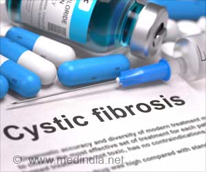 Cystic Fibrosis Carriers More Likely to Experience Digestive Symptoms
