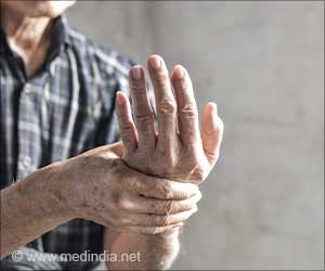 Complex Autoantibody Profiles in Rheumatoid Arthritis