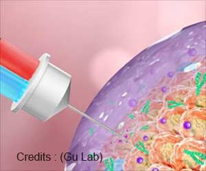 New Injectable Gel Therapy To Deliver Both Chemotherapeutics And Immunotherapeutics