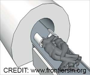 Touch Sensation and Brain Activity Studied Between Couples Using FMRI