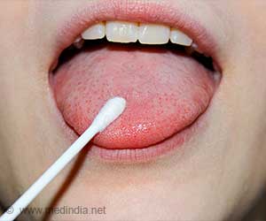 How Tongue Swabs Improve Tuberculosis Detection Accuracy