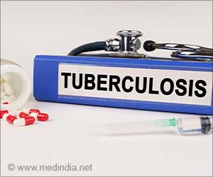 Undernourished Household Members at Higher TB Risk Post-Exposure