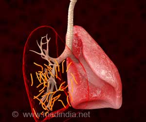  Tuberculosis Treatment Time Could Be Lessened by Higher Doses of Rifampin