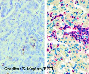 Targeting Immune Cells That Aid Tumor Growth May Enhance Tumor Response To Immunotherapy