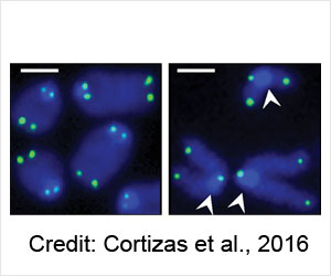 Non-Hodgkin's Lymphoma Aided by Uracil DNA Glycosylase (UNG) Non-Hodgkin's Lymphoma Aided by Uracil DNA Glycosylase (UNG)