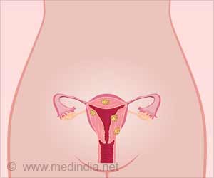 How Tracing Uterine Fibroids Growth Open Novel Therapeutics?