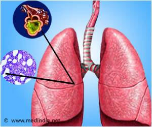 MHRA Issues a Drug Safety Alert After Fatal Cases of Liver Injury With Lung Antifibrotics