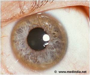 Guidelines to the Diagnosis and Management of Wilson's Disease