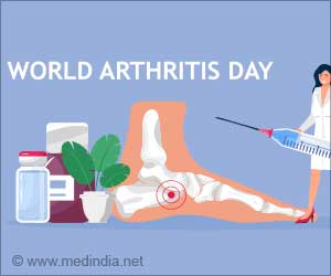 World Arthritis Day 2022: Its in Your Hands, Take Action