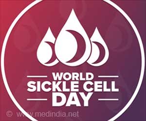 World Sickle Cell Day 2021: Let's Shine the Light on Sickle Cell