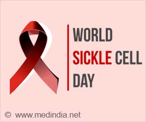 World Sickle Cell Day: Understanding and Supporting Those With Sickle Cell Anemia