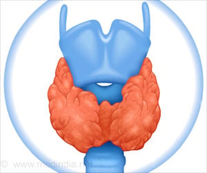 High Thyroid Hormones Linked to Cognitive Disorders