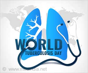 World Tuberculosis (TB) Day 2022  Invest to End TB. Save Lives