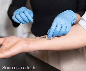 Caltech's ICares Smart Bandage Speeds Wound Healing