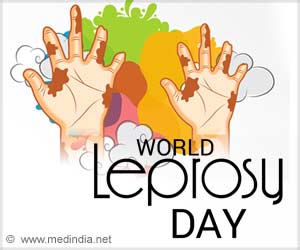 World Leprosy Day: Zero Disabilities in Girls and Boys