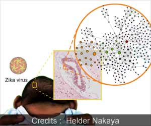 Zika Virus During Pregnancy can Affect the Fetal Brain