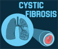 Cystic Fibrosis Cystic Fibrosis