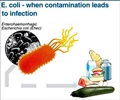E.coli - Infection