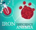 Iron Deficiency Anemia Iron Deficiency Anemia