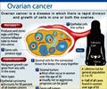 Ovarian Cancer / Cancer of Ovary Ovarian Cancer / Cancer of Ovary