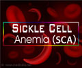 Sickle cell anemia