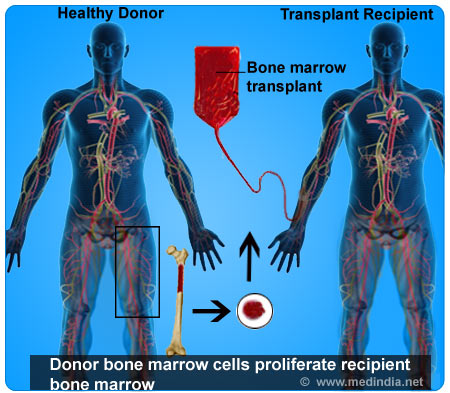 Bone Marrow Transplantation