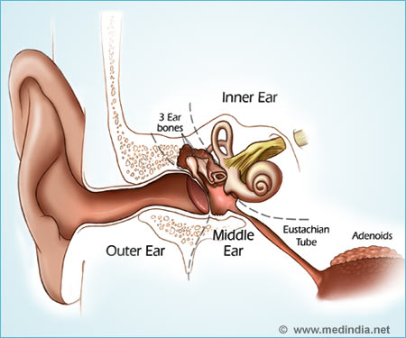Otitis Media/ Middle Ear Infection - Infographic