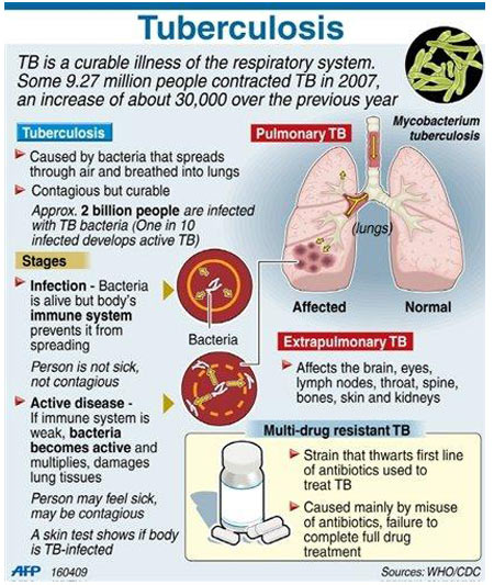 Tuberculosis - Test Kit