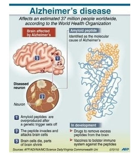 Alzheimer's Disease - Gene Boosts Memory