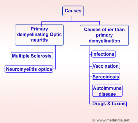 Optic Neuritis - Causes