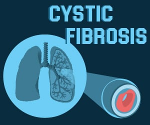 Infographics on Cystic Fibrosis Infographics on Cystic Fibrosis