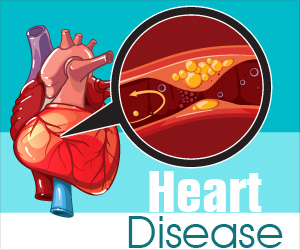 Infographics on Heart Disease
