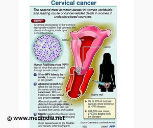 Infographics on Meningitis Vaccine