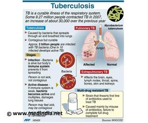 Infographics on Tuberculosis - Test Kit