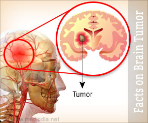 brain facts tumor health