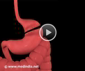 Bariatric Surgery - Gastric Bypass Procedure