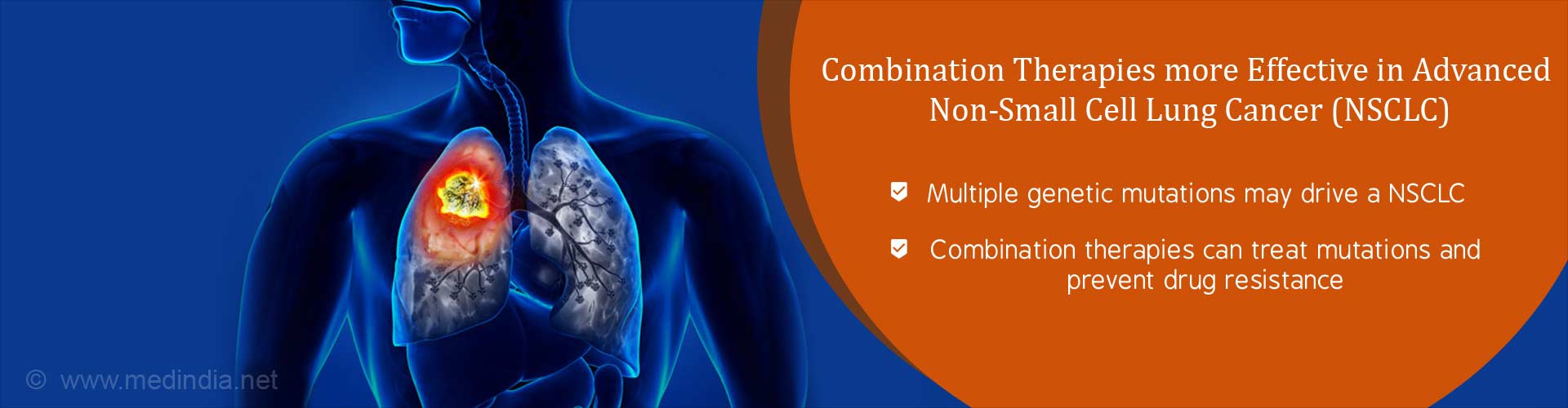 combination therapies more effective in advanced non-small cell lung cancer (NSCLC)
- multiple genetic mutations may drive a NSCLC
- combination therapies can treat mutations and prevent drug resistance