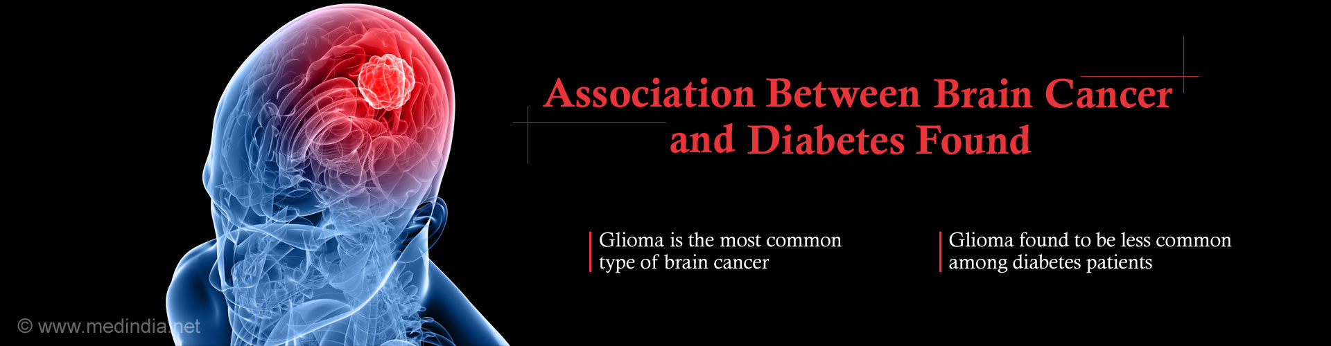 Association between brain cancer and diabetes found
- Gliome is most common type of brain cancer
- Glioma found to be less common among diabetes patients