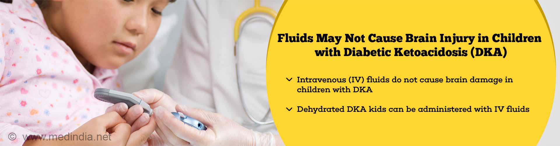 Fluids may not cause brain injury in children with diabetic ketoacidosis (DKA). Intravenous (IV) fluids do not cause brain damage in children with DKA. Dehydrated DKA kids can be administered with IV fluids.