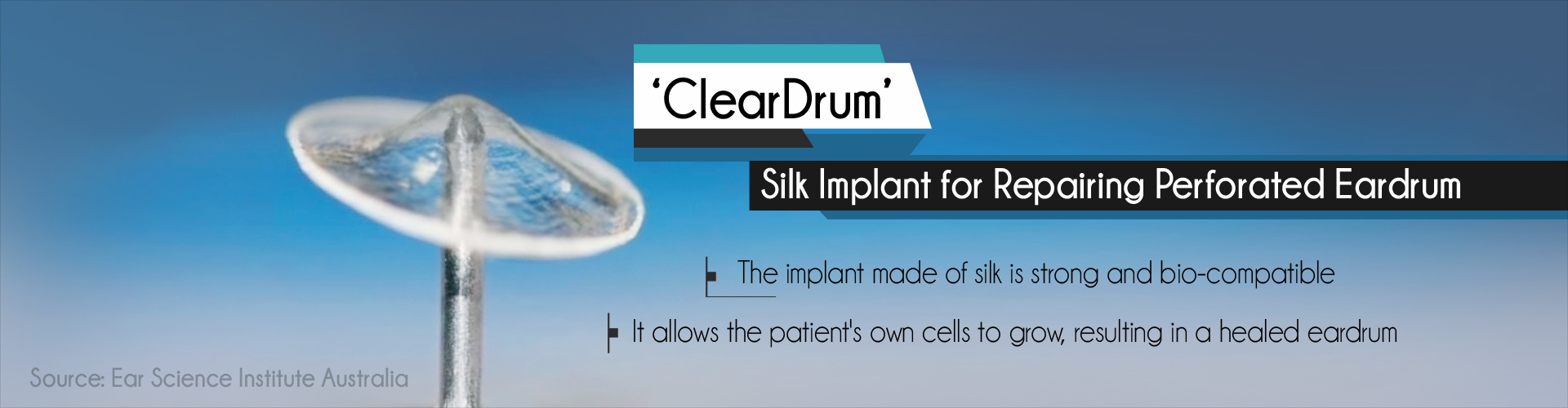 ''ClearDrum'' silk implant for repairing perforated eardrum
- The implant made of silk is strong and bio-compatible
- It allows the patient''s own cells to grow, resulting in a healed eardrum