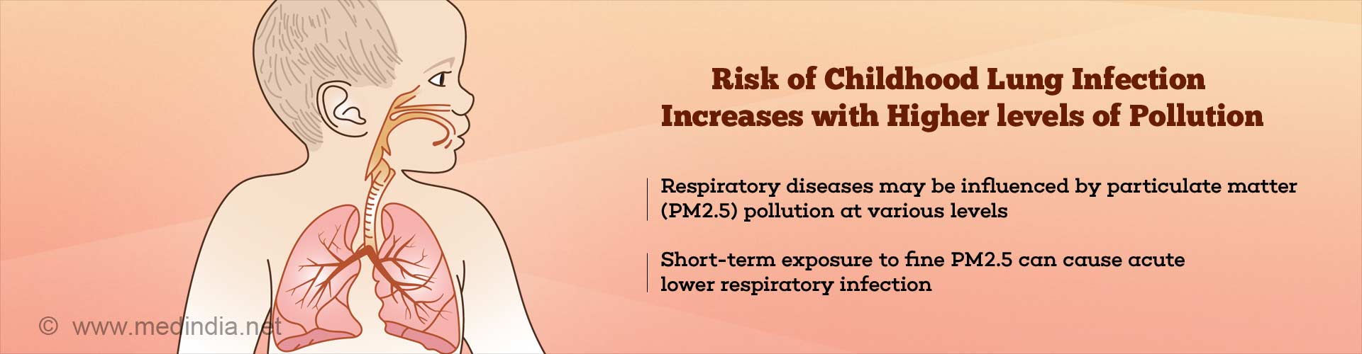 Risk of childhood lung infection increases with higher levels of pollution
- Respiratory disease may be influenced by particulate matter (PM2.5) pollution at various levels
- short-term exposure to fine PM2.5 can cause acute lower respiratory infection