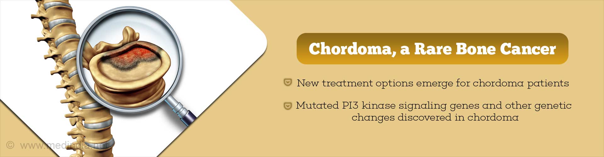 chordoma, a rare bone cancer
- new treatment options emerge for chordoma patients
- mutated p13 kinase signaling genes and other genetic changes discovered in chordoma