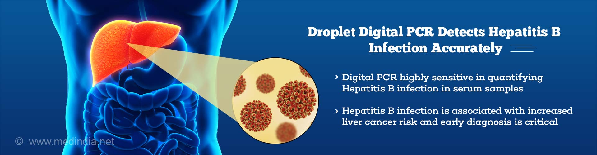 Droplet Digital PCR Detects Hepatitis B Infection Accurately
- Digital PCR highly sensitive in quantifying Hepatitis B infection in serum samples
- Hepatitis B infection is associated with increased liver cancer risk and early diagnosis is critical