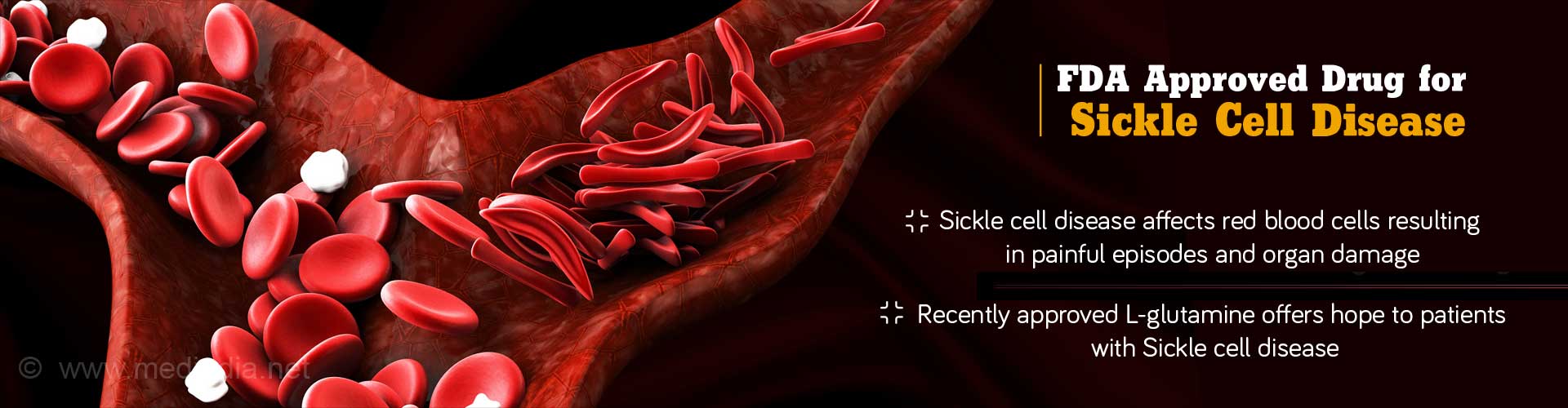 FDA approved drug for sickle cell disease
- Sickle cell disease affects red blood cells resulting in painful episodes and organ damage
Recently approved L-glutamine offers hope to patients with Sickle cell disease