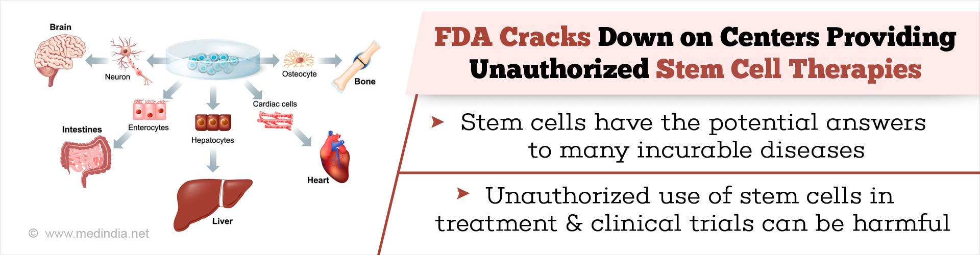 FDA cracks down on centers providing unauthorized stem cells therapies
- stem cells have the potential answers to many incurable diseases
- Unauthorized use of stem cells in treatment & clinical trials can be harmful