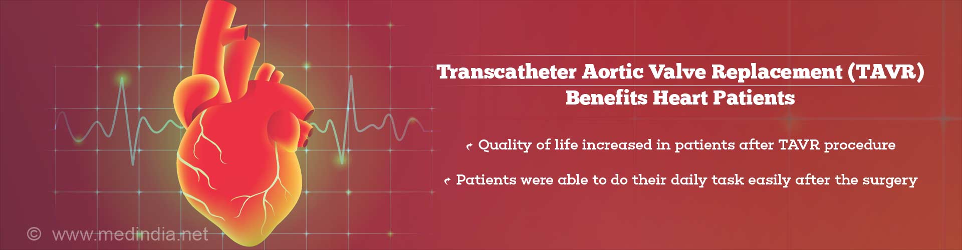 transcatheter aortic valve replacement (tavr) benefits heart patients
- quality of life increased in patients after tavr procedure
- patients were able to do their daily task easily after the surgery
