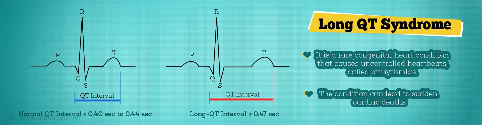 Qt Interval Chart