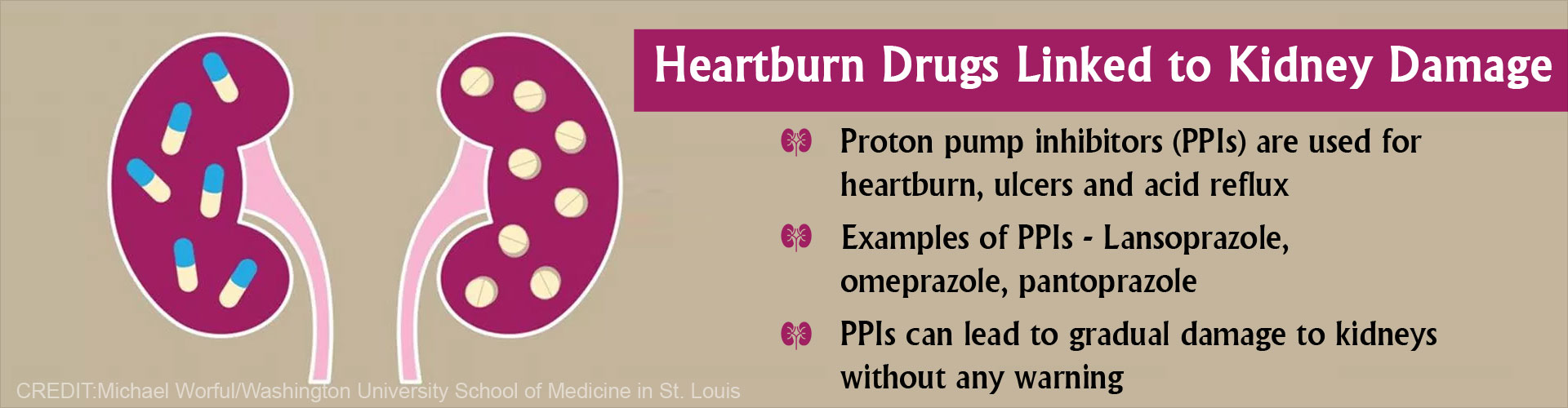 Heartburn drugs linked to kidney damage
- Proton pump inhibitors (PPIs) are used for heartburn, ulcers and acid reflux
- Examples of PPIs - lansoprazole, omeprazole, pantoprazole
- PPIs can lead to gradual damage to without any warning
